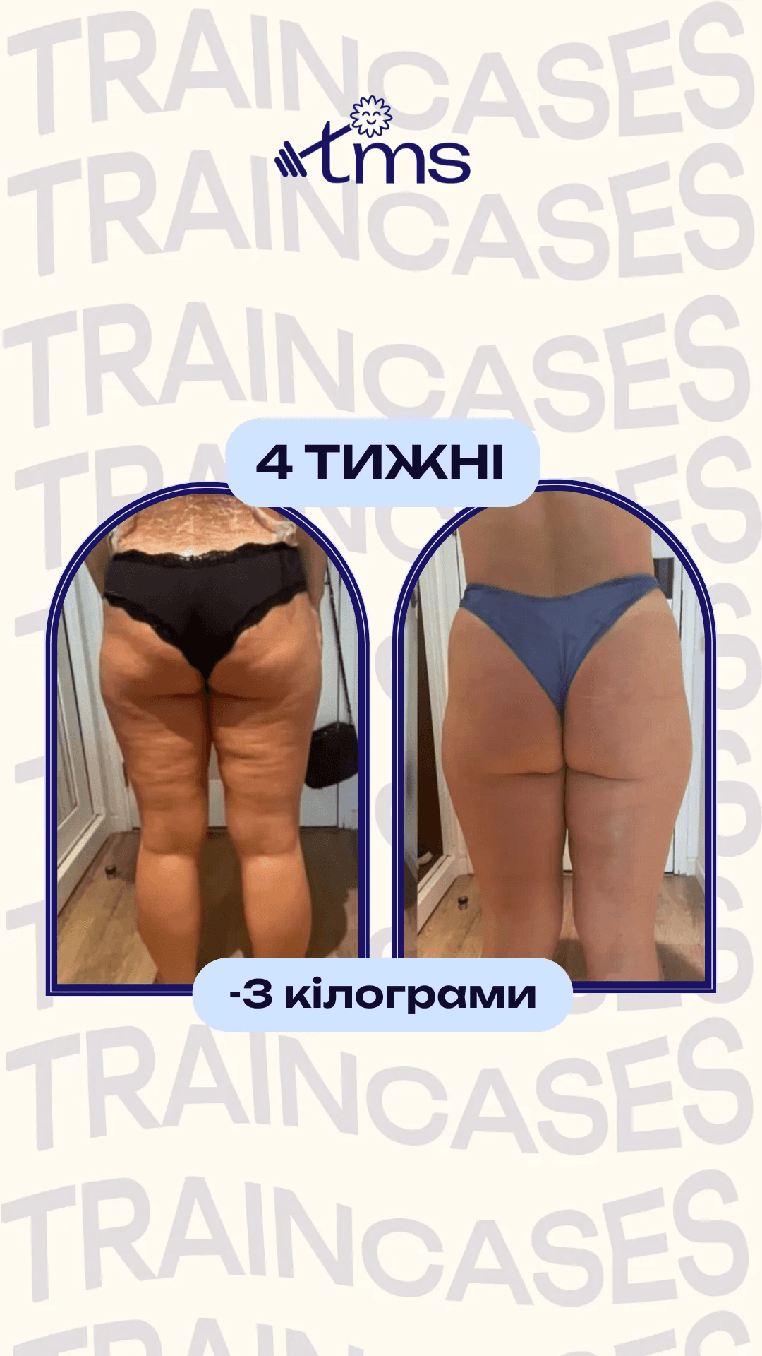 Кейс 2: покращене якості тіла